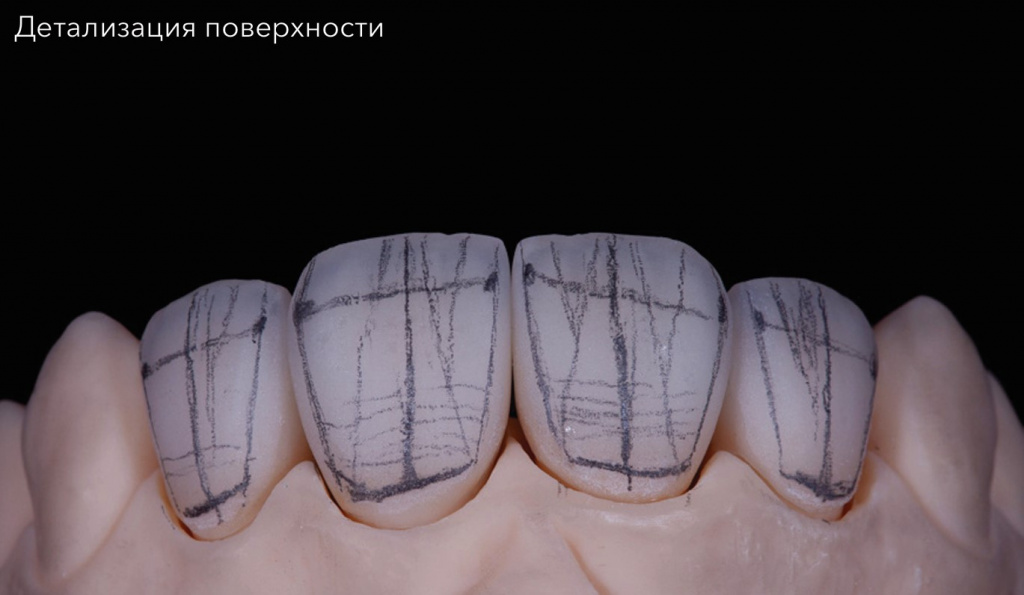 Детализация поверхности
