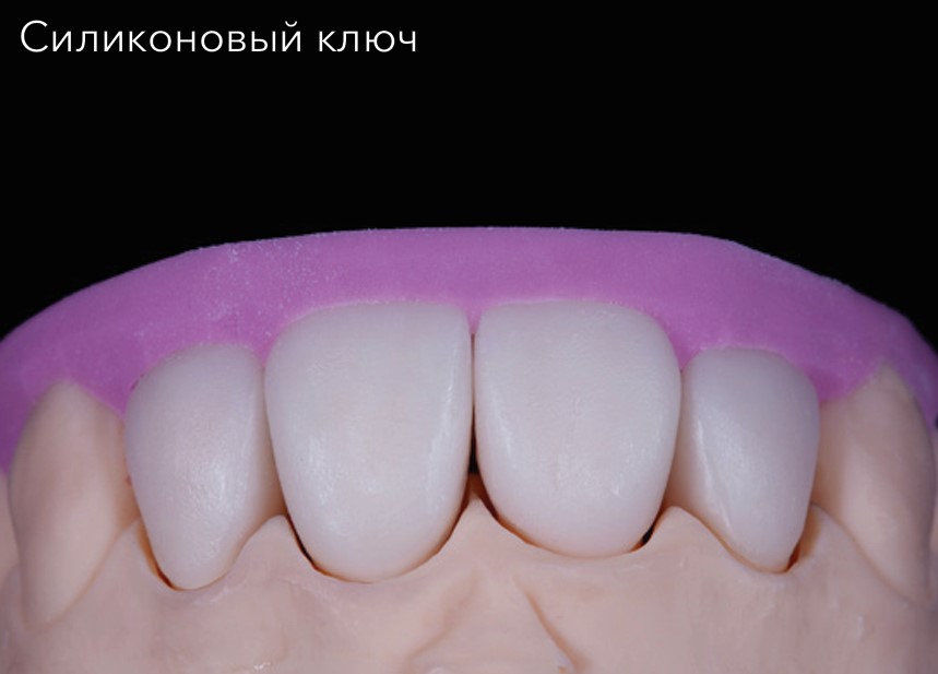 Силиконовый ключ
